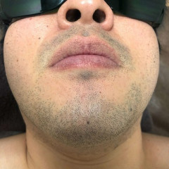 【悲報】青髭、ガチで消えないｗｗｗｗｗｗｗｗｗｗｗ