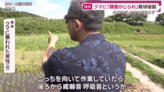 【悲報】クマに顔面かじられた男性、眼球破裂
