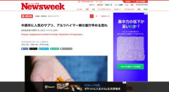 【悲報】グルコサミンを飲むとアルツハイマー病の進行を加速させる可能性が浮上
