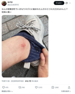 【画像】歌舞伎町、人を噛むネズミが現れるｗｗｗｗ