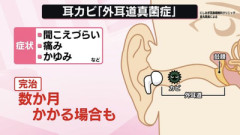 【警告】医師『イヤホン長時間使用で”耳カビ”生えた人の末路がこれ』