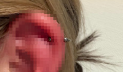 ノリで耳にピアス開けた女性さん、マジでヤバイことになる・・・