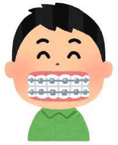 友達『えっ！お前歯の矯正始めたの！？』ワイ『うん。歯並び悪いのコンプレックスだったからさぁ～』