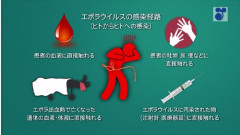 【悲報】エボラ出血熱、フランスで初確認