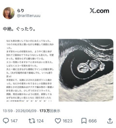女ニコ生主さん「中絶しました😭」→突然の逝去報告