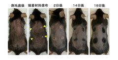 九州歯科大学「ハゲに接着剤を塗ると毛が生える。ね、簡単でしょ？」