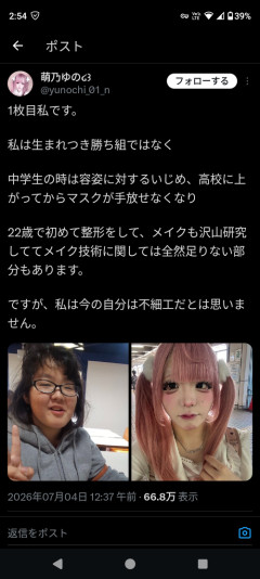 【画像】イジメられてた女の子、整形して人生を変えるｗｗｗｗ