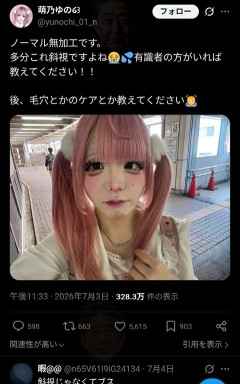 【画像】地雷系女子「これって斜視だよね？😭」→結果wwwwwwwwwww