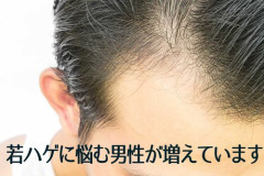 【悲報】神様「うーん…コイツはち◯こ小さくしたろ」「コイツは20代からハゲるようにしたろ」