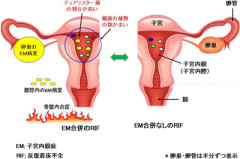 【画像】不妊症の女性、膣内から『あるはずのないもの』が検出される…