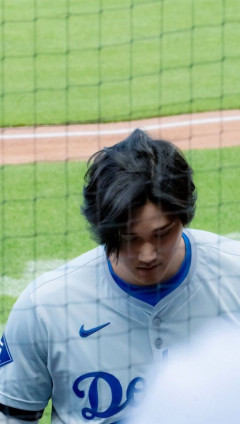 【悲報】大谷翔平さん(31)の頭皮、逝く