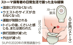 松本人志(62歳)さん、大腸がんで人工肛門を造設　もう旅行に行けない…
