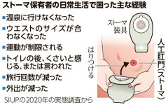 【悲報】大腸がんの松本人志さん、人工肛門になってしまう