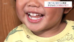 お口がぽかん 子どもの口腔機能発達不全症が全国で増加 昔ながらの遊び減少も原因に
