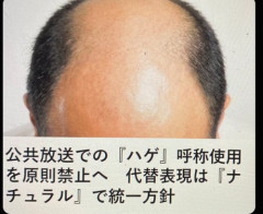 【困惑】公共放送での『ハゲ』呼称使用を原則禁止へ代替表現は『ナチュラル』で統一方針