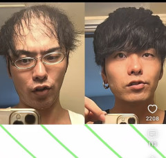 【画像】薄毛男性、最後の抵抗で隠してセットしてみた結果ｗｗｗｗｗ