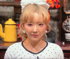 【ヘルタースケルター】整形手術を１１回やった結果