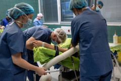 コンドームの代わりに超強力な瞬間接着剤をチ○ポに塗ってセ○クスした男が死亡