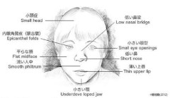 特徴的な顔つきや知的障害の子を産むのは「リスク」？ 国が進める「プレコン」に潜む問題点とは 「あってはならない恐怖として描かれている」と批判【やまゆり園事件10年】