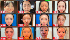 【画像】11回整形した姉ちゃん、12回目で究極の美を手に入れる