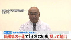 【悲報】京大病院、患者の脳の正常な部分を摘出してしまう痛恨のミス