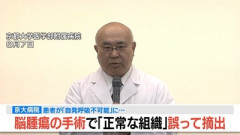 【速報】京大病院、手術ミスで『正常な脳』を摘出 → 患者は自発呼吸不可能な植物状態に