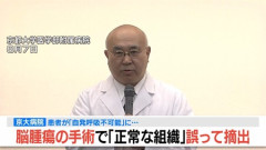 【悲報】京大病院さん　脳腫瘍手術中正常な脳組織を摘出してしまう