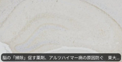 韓国人「日本が老廃物を洗い流す画期的な薬剤の開発に成功！アルツハイマー病の原因物質の蓄積を劇的に防げる可能性‥」