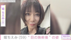 堀ちえみ（59）、“目の施術後”の自撮り写真を公開「とっても好みな仕上がり」 （※画像あり）