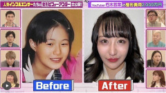 【画像】現代の整形、ここまで綺麗になる
