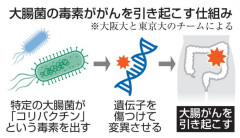 【速報】大腸がんになる理由、『大腸菌が出す毒素』だった…