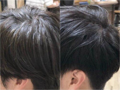 【悲報】白髪が大量繁殖し始めました画像あり