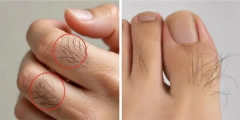 【画像】手と足に指毛が生えてる奴、もれなくADHDらしいｗｗｗｗ