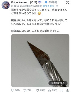 【悲報】人気VTuber、ちょっとヤバそうな怪我をする。おまえらの想像の1.3倍ヤバそうｗｗｗｗ