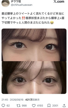 【画像】美容系女子、遂に「人間のまぶた」を手に入れて泣くｗｗｗｗ