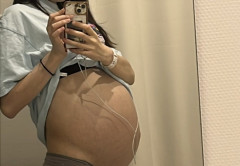 女性「なんかお腹出てきてヤバいんだけどｗ」ﾊﾟｼｬｯ→衝撃の原因が明らかに・・・
