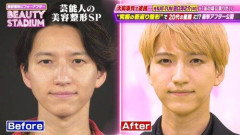 【画像】田口淳之介、40歳で〝若返り整形〟「私が知ってる田口淳之介じゃない」