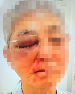 こんな甘い処分で少年たちの暴走を止められるのか…“バールで頭を殴打”の17歳が「逆送なし」で少年院に　79歳被害者の思い