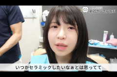 【画像】ボロボロ歯で笑顔を失ったJK、歯医者で純白の歯を手に入れて笑顔を取り戻すｗｗ