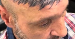 男「植毛は嫌だ！でも…せや！」 → とんでもない方法で髪の毛が生えているように見えさせるｗｗｗｗ