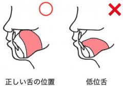 【画像】舌の正しい位置、意味不明