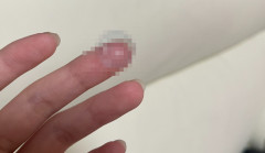 「ここ数日、左目がずっと見えづらくてモヤモヤしてる。なんだろ？」 → 衝撃の原因が判明ｗｗｗｗｗ