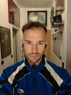 【悲報】20代男性、ストレスでハゲるも「もう苦しみたくない」と抗うことを辞めるｗｗｗｗ