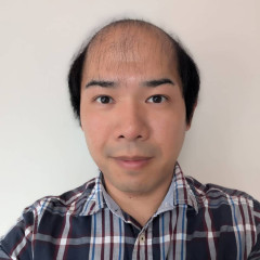 【画像】薄毛の男性→思い切って坊主頭にしてみたら……　“驚きの変化”に「清潔感ありますね！」