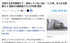 【医療ミス】骨折してない足に間違えて人工骨を入れる手術　術後のレントゲン撮影で判明