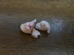 【閲覧注意】ワイが抜いてもらった『歯茎に完全に埋まってた親知らず』、割とグロい