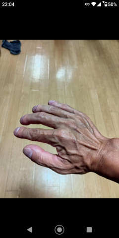 【画像】Xまんさん「こういう風に手に血管が浮き出てる男とは付き合っちゃだめ！」