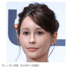 【衝撃】ダレノガレ明美さん、“整形疑惑”に「6文字」で返答・・・・・・・・・