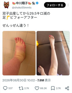 【朗報】中川翔子さん、とんでもないビフォーアフターを見せてしまう