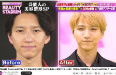 【困惑】元KAT-TUN・田口淳之介、整形後に「誰だよ、前が良いって言ってるの」
